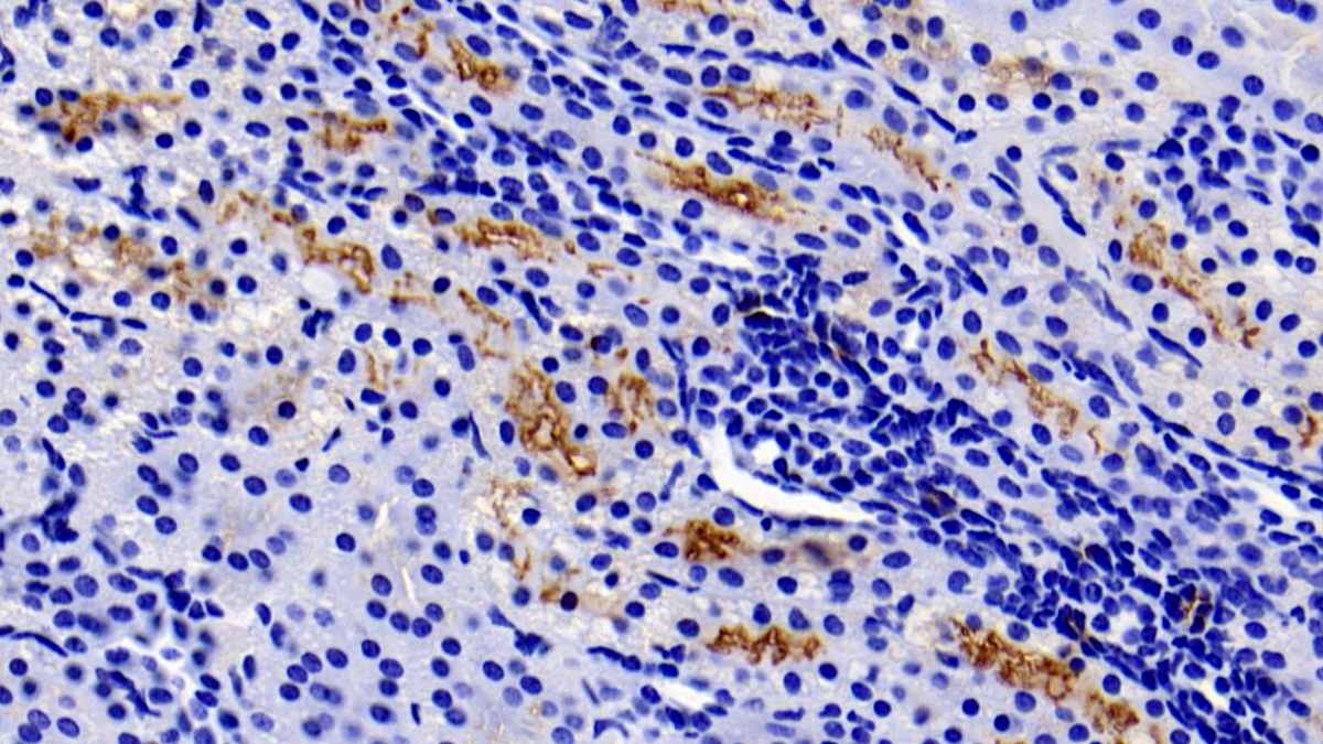 Monoclonal Antibody to Gamma-Glutamyltransferase 1 (gGT1)