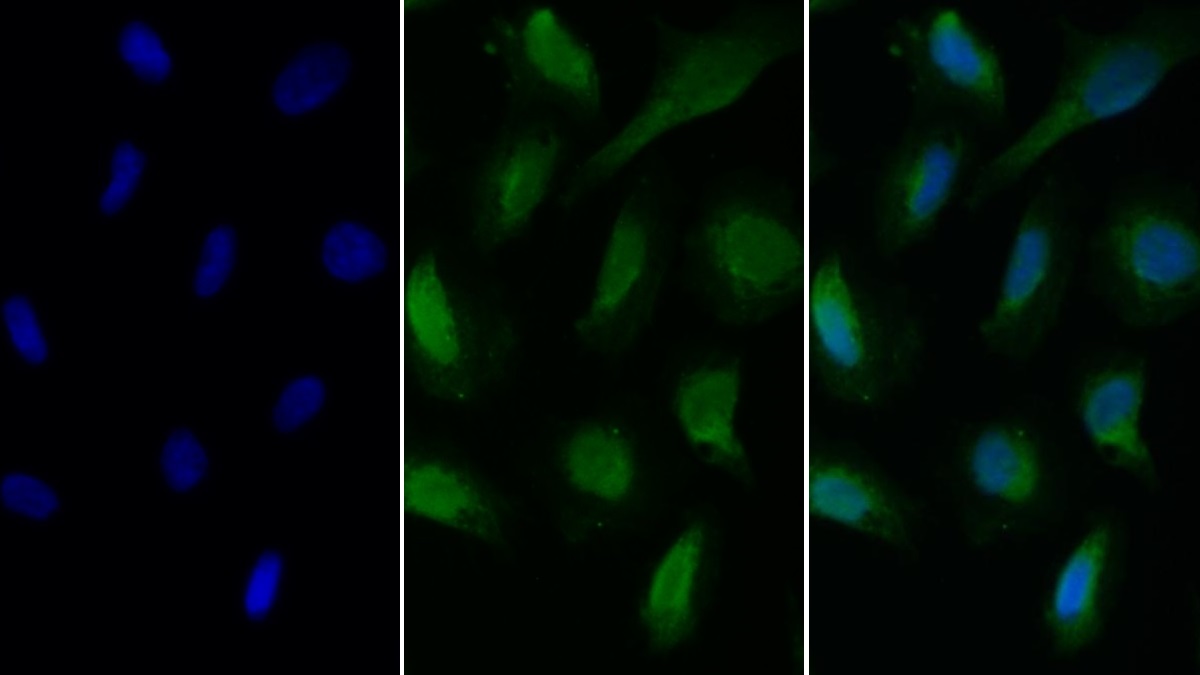 Monoclonal Antibody to Cluster of Differentiation 79B (CD79B)