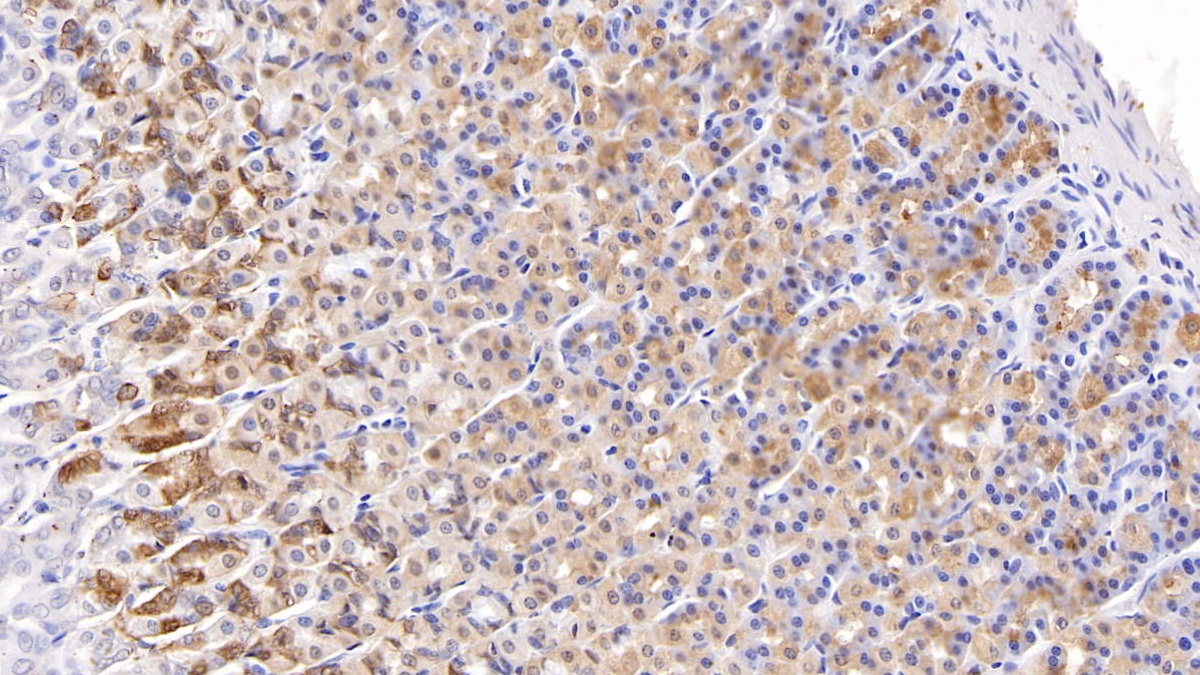 Monoclonal Antibody to Neutrophil gelatinase-associated lipocalin (NGAL)