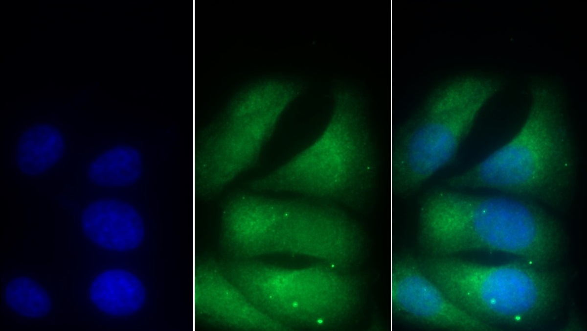 Monoclonal Antibody to Cluster of Differentiation 90 (CD90)