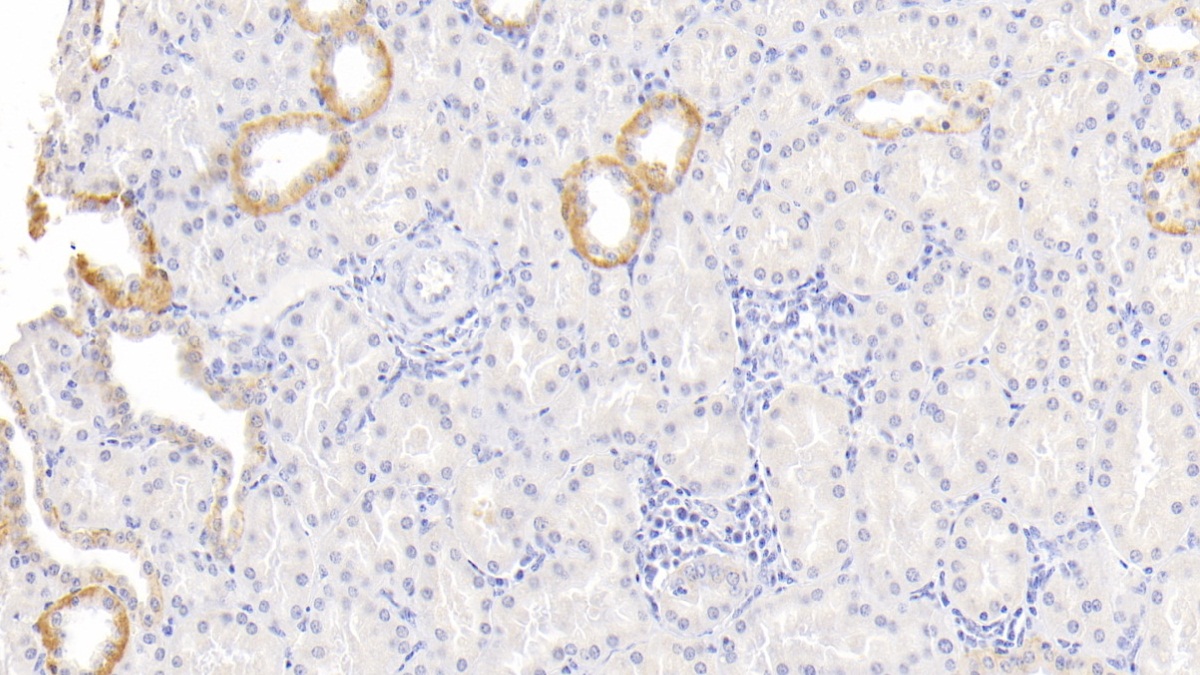 Monoclonal Antibody to Lipopolysaccharide Binding Protein (LBP)