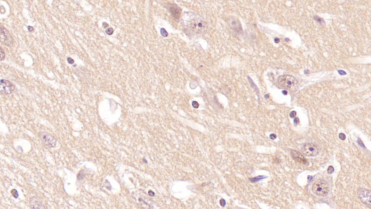 Monoclonal Antibody to Cluster Of Differentiation 97 (CD97)