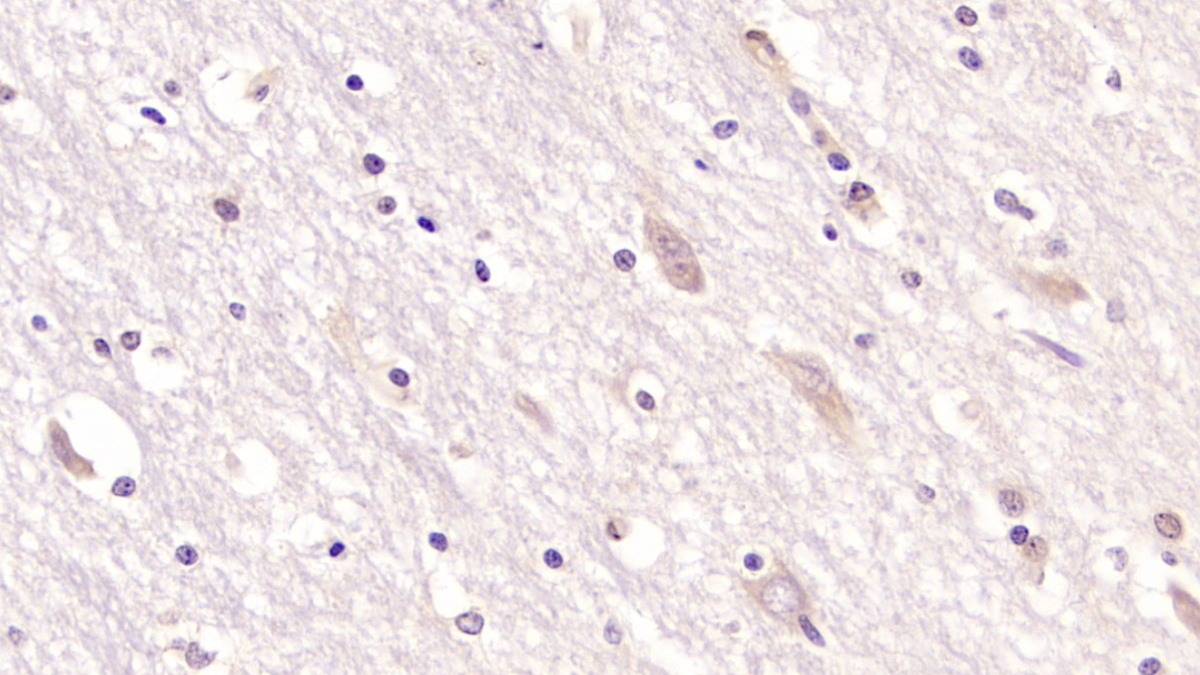 Monoclonal Antibody to Cluster Of Differentiation 97 (CD97)