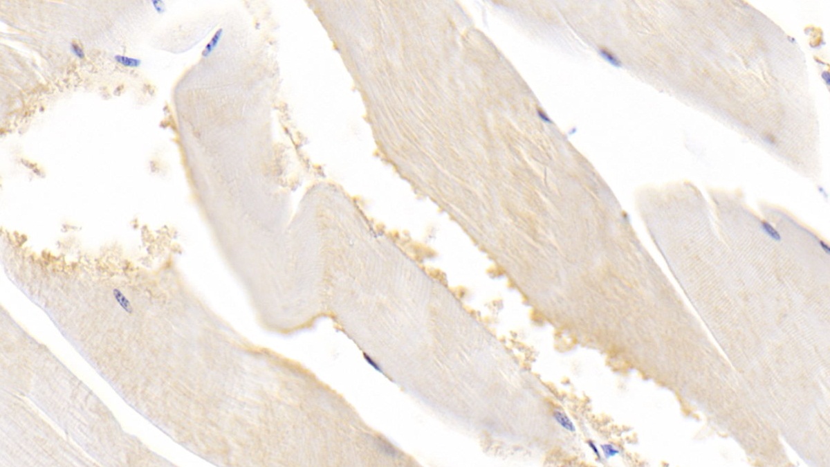 Monoclonal Antibody to Acetylcholinesterase (ACHE)