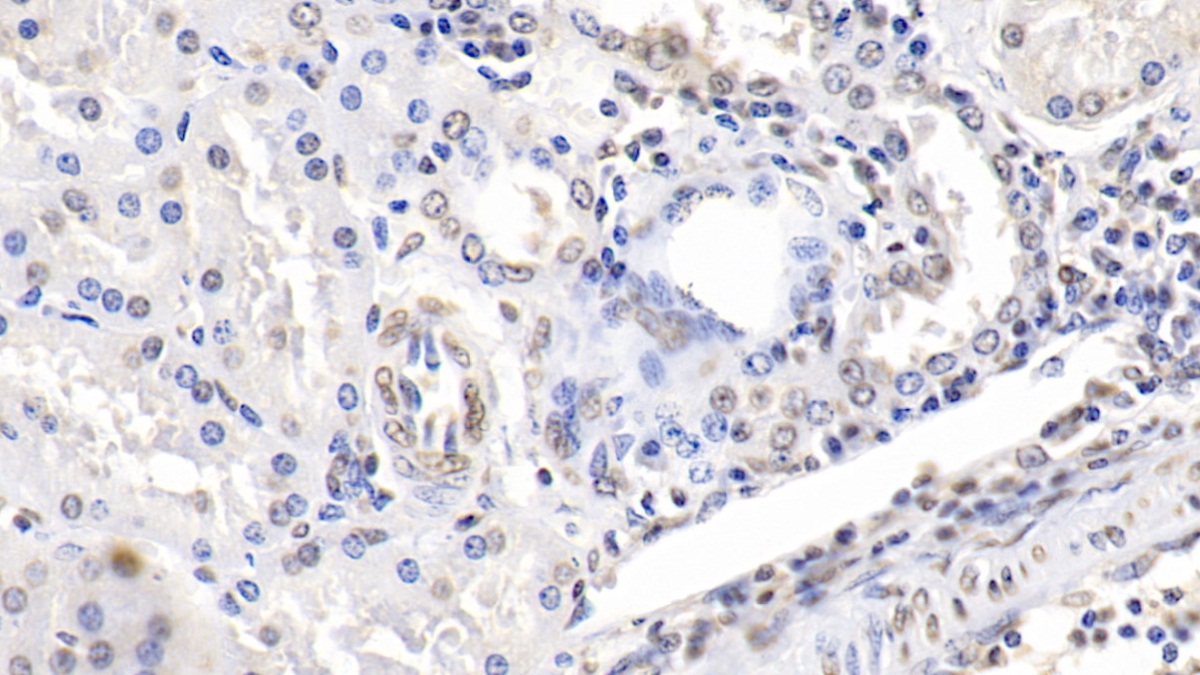 Monoclonal Antibody to Enolase 1 (ENO1)