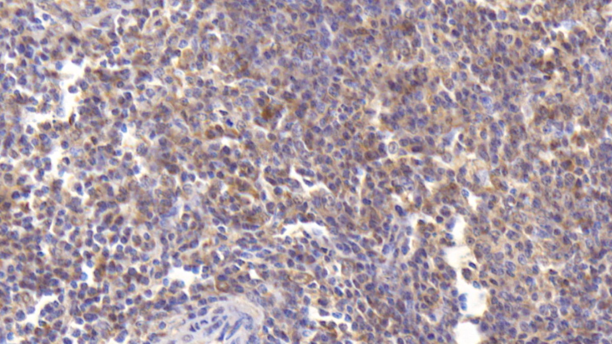 Monoclonal Antibody to Azurocidin (AZU)