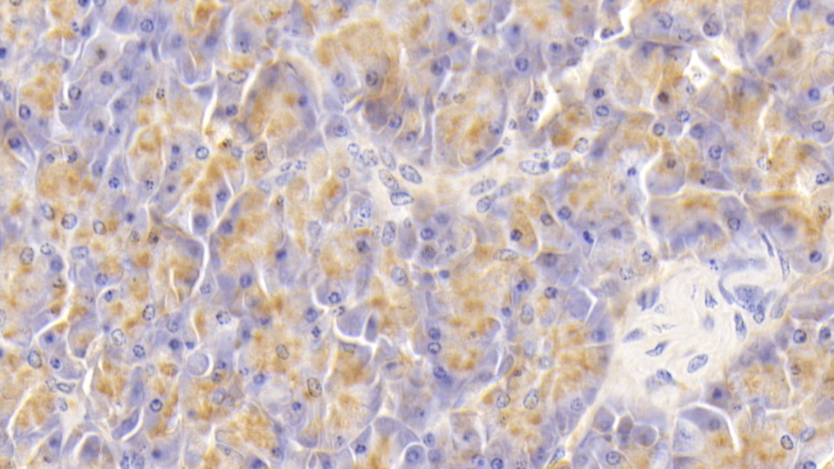 Monoclonal Antibody to Salivary Alpha Amylase (AMY1A)