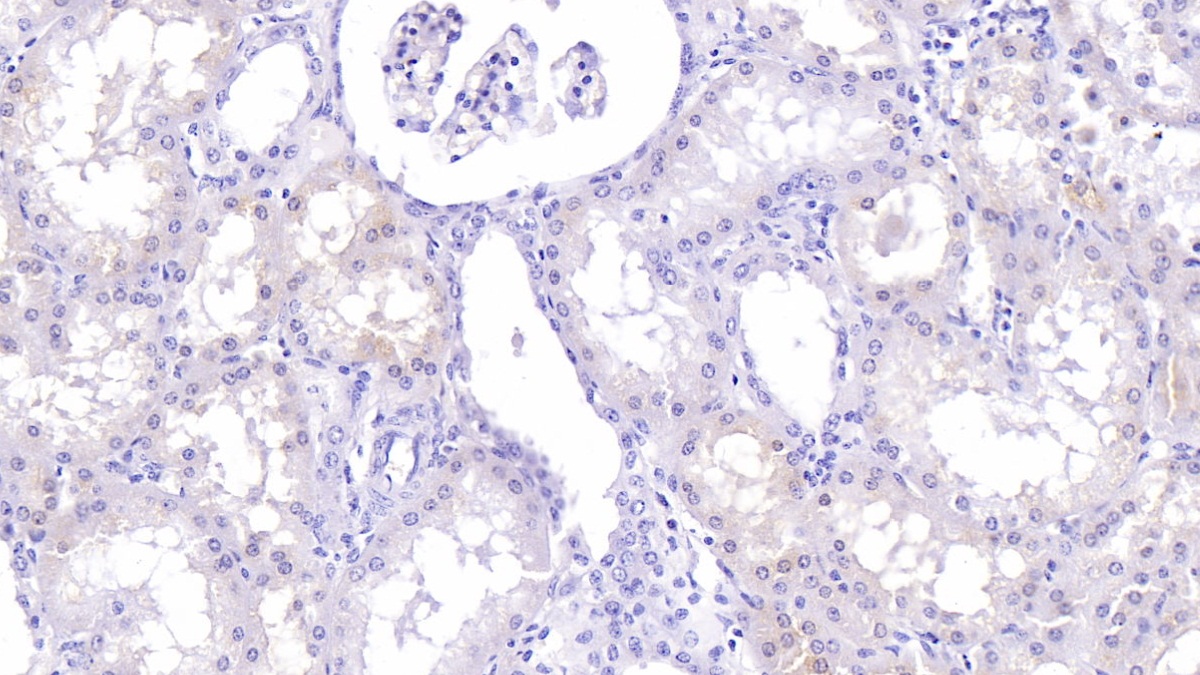 Monoclonal Antibody to Lumican (LUM)