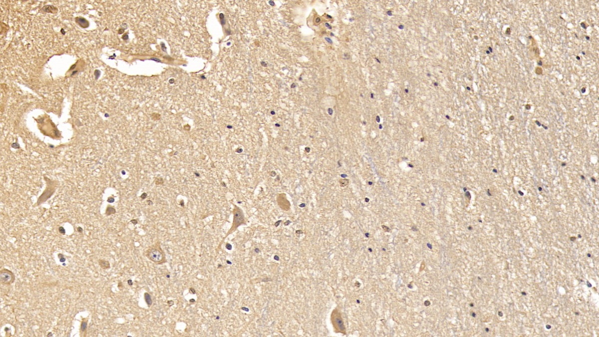 Monoclonal Antibody to Dystrophin (DMD)