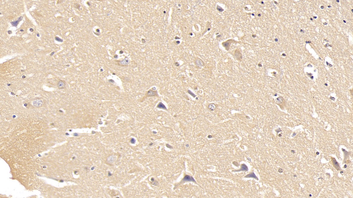 Monoclonal Antibody to Dystrophin (DMD)