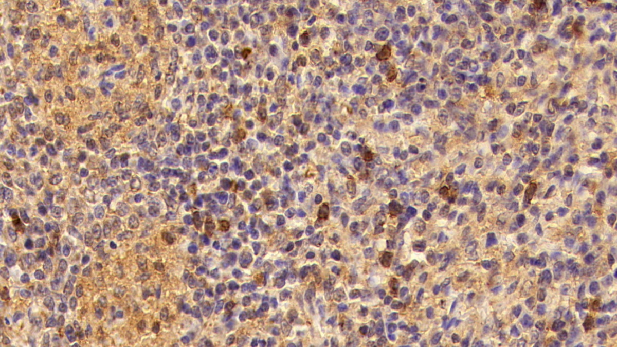 Monoclonal Antibody to Killer Cell Immunoglobulin Like Receptor 2DL1 (KIR2DL1)