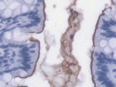 Monoclonal Antibody to Lipopolysaccharide (LPS)