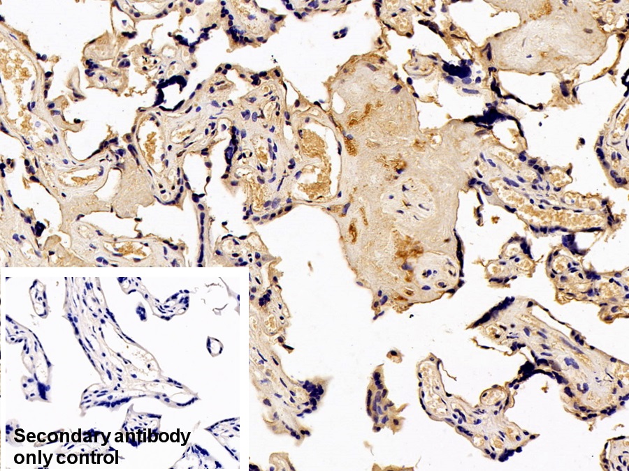 Monoclonal Antibody to Serum Amyloid P Component (SAP)