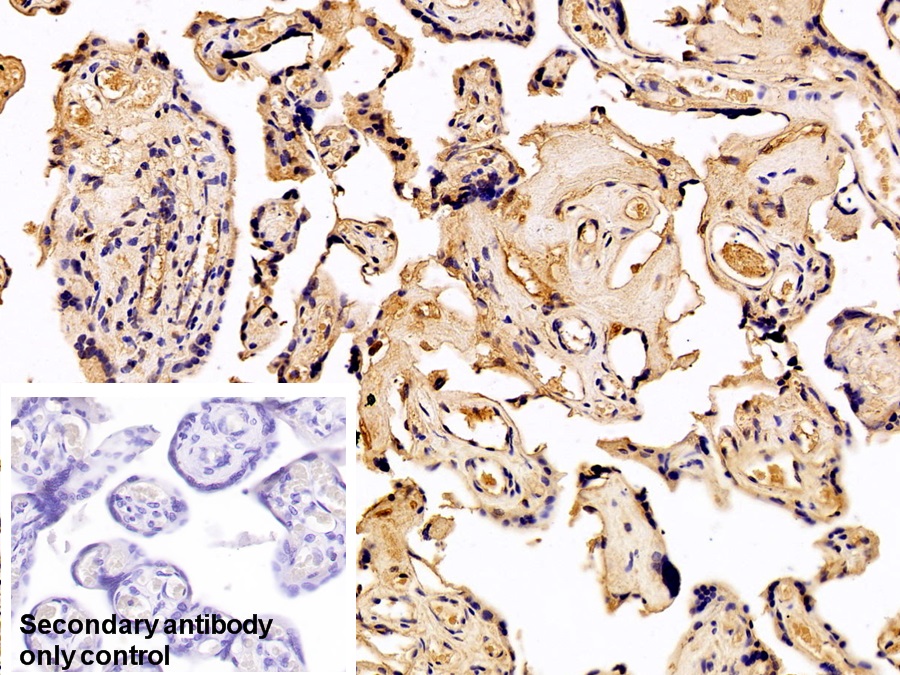 Monoclonal Antibody to Serum Amyloid P Component (SAP)