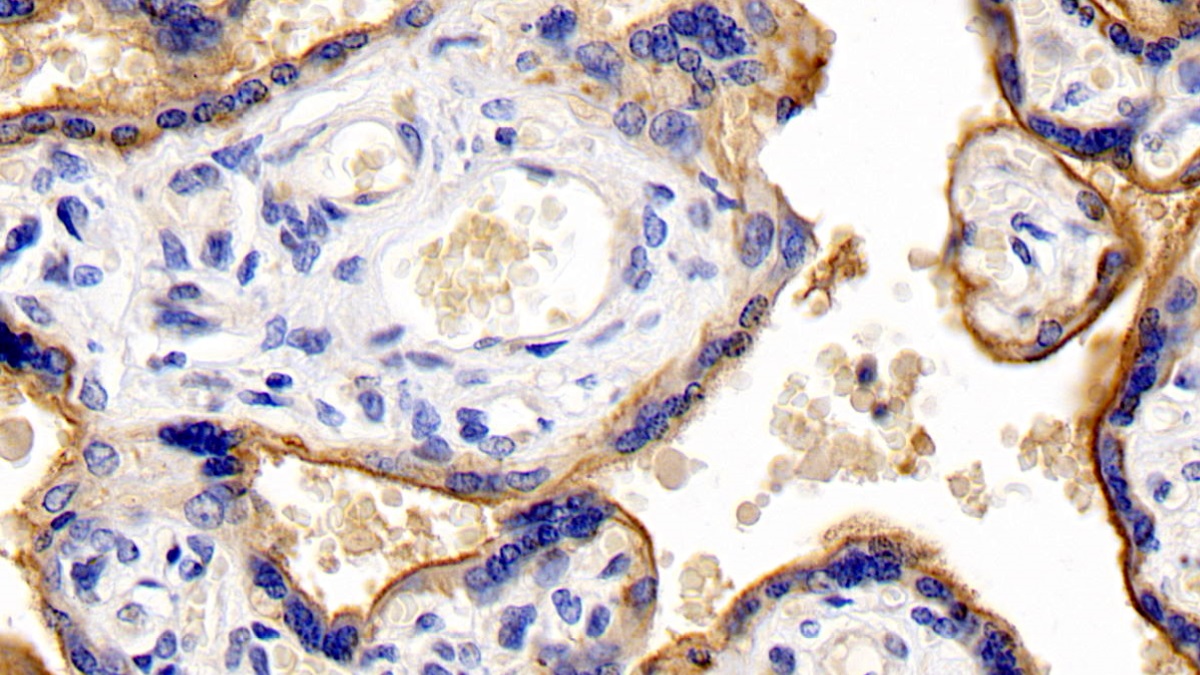 Monoclonal Antibody to Cluster Of Differentiation 147 (CD147)