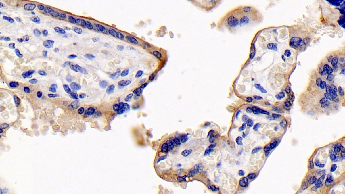 Monoclonal Antibody to Cluster Of Differentiation 147 (CD147)