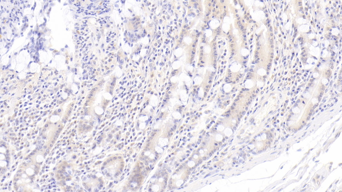 Monoclonal Antibody to Indoleamine-2,3-Dioxygenase (IDO)