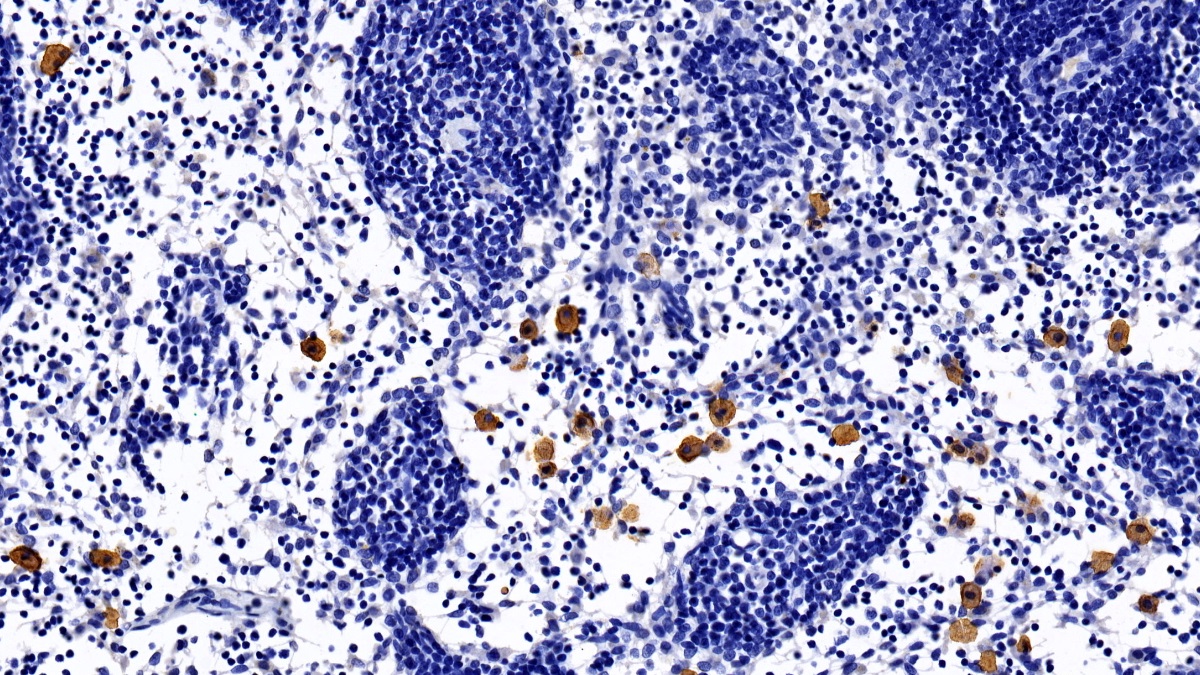 Monoclonal Antibody to Bone Marrow Stromal Cell Antigen 1 (BST1)