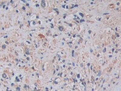 Monoclonal Antibody to A Disintegrin And Metalloprotease 17 (ADAM17)