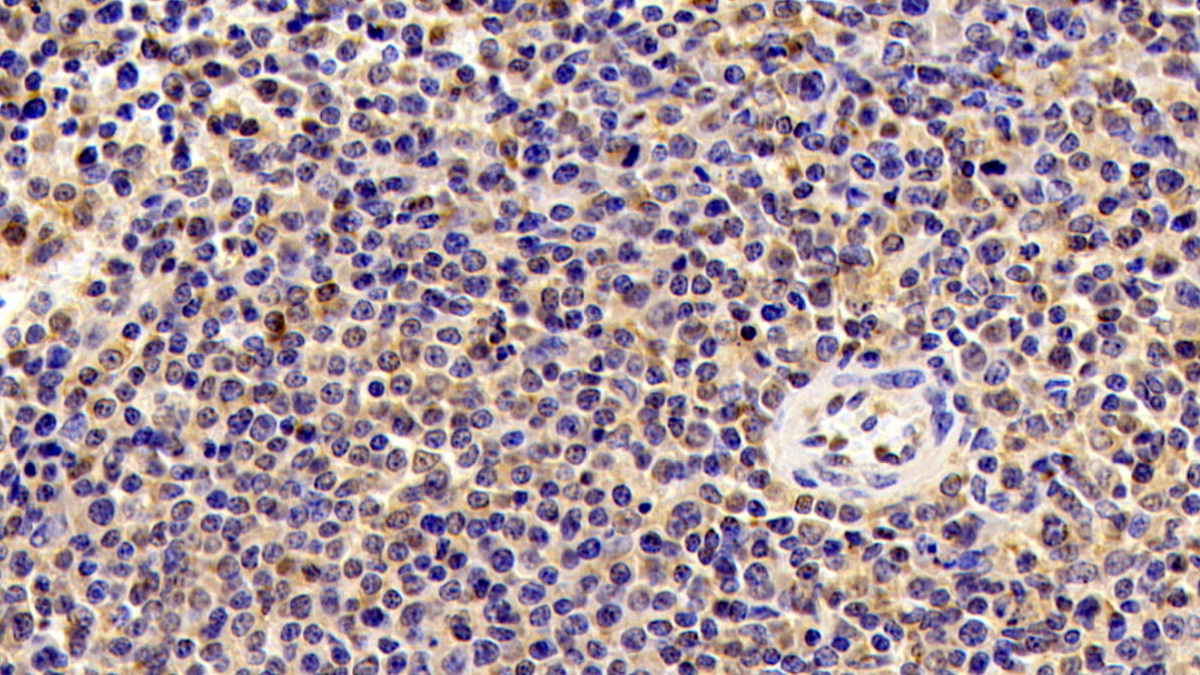 Monoclonal Antibody to Cofilin 1 (CFL1)