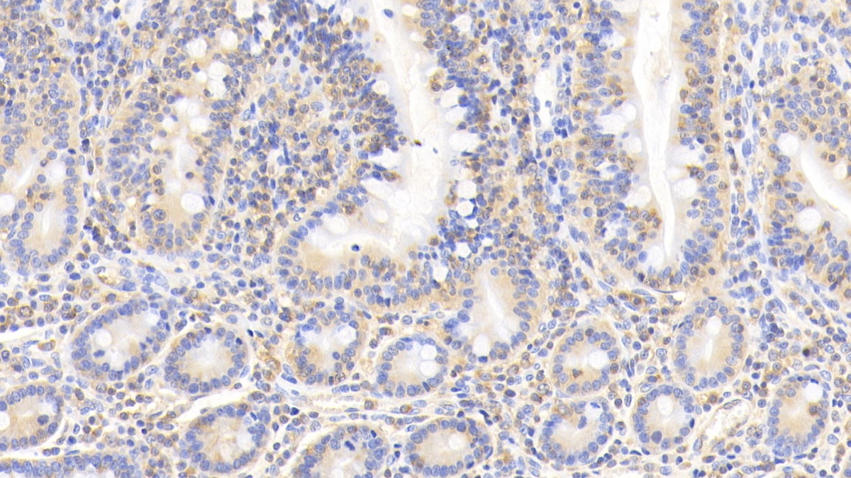 Monoclonal Antibody to Cofilin 1 (CFL1)