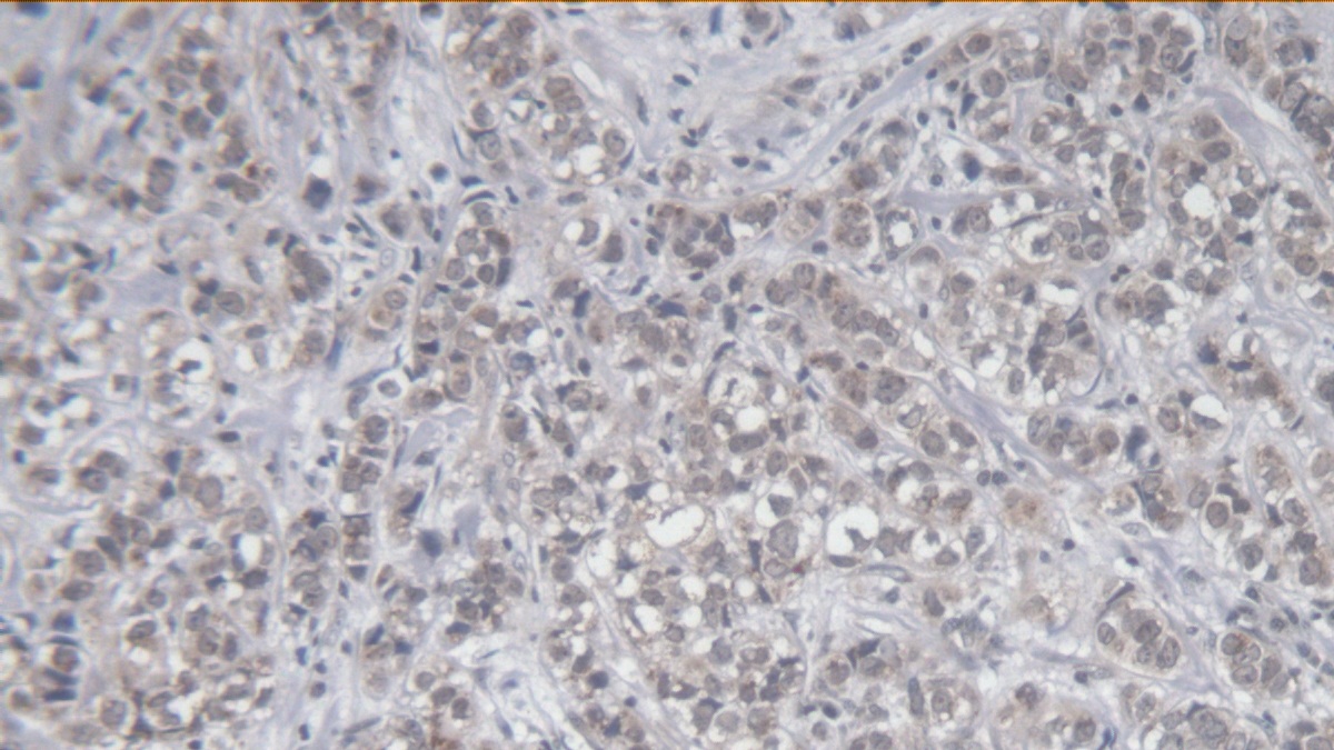 Monoclonal Antibody to Killer Cell Immunoglobulin Like Receptor 2DS4 (KIR2DS4)