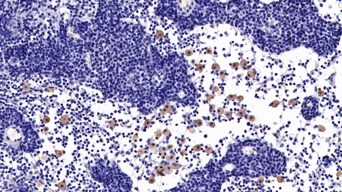 Monoclonal Antibody to Cluster Of Differentiation 23 (CD23)