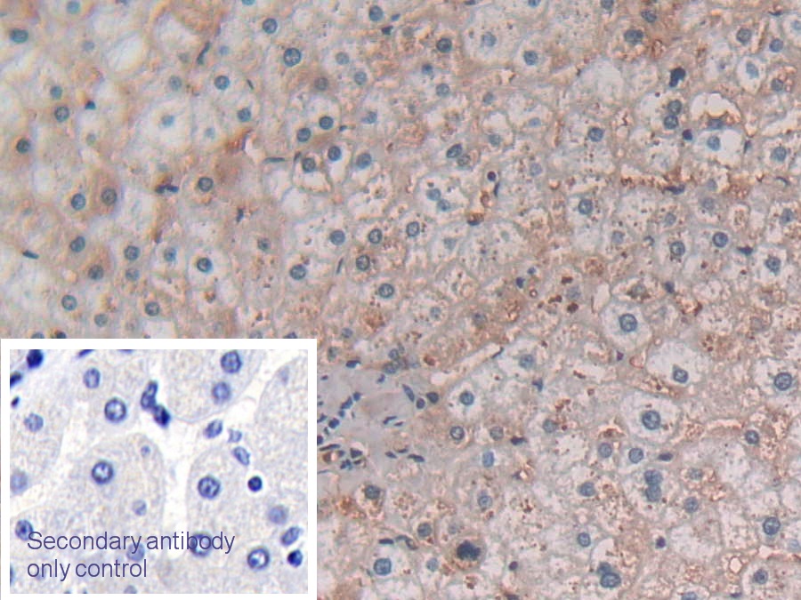 Monoclonal Antibody to Cytosolic Phospholipase A2 (PLA2G4)