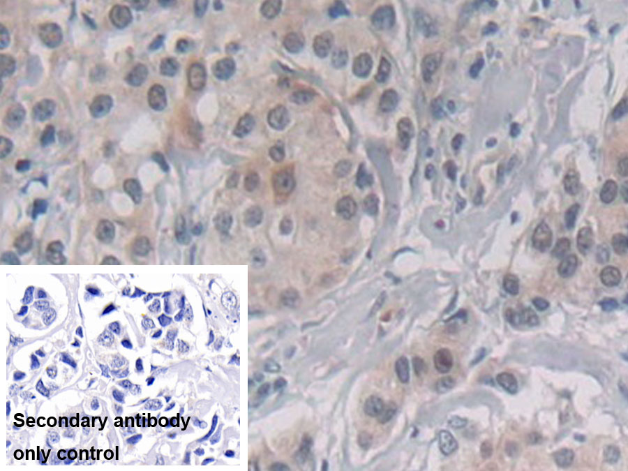 Monoclonal Antibody to Cytosolic Phospholipase A2 (PLA2G4)