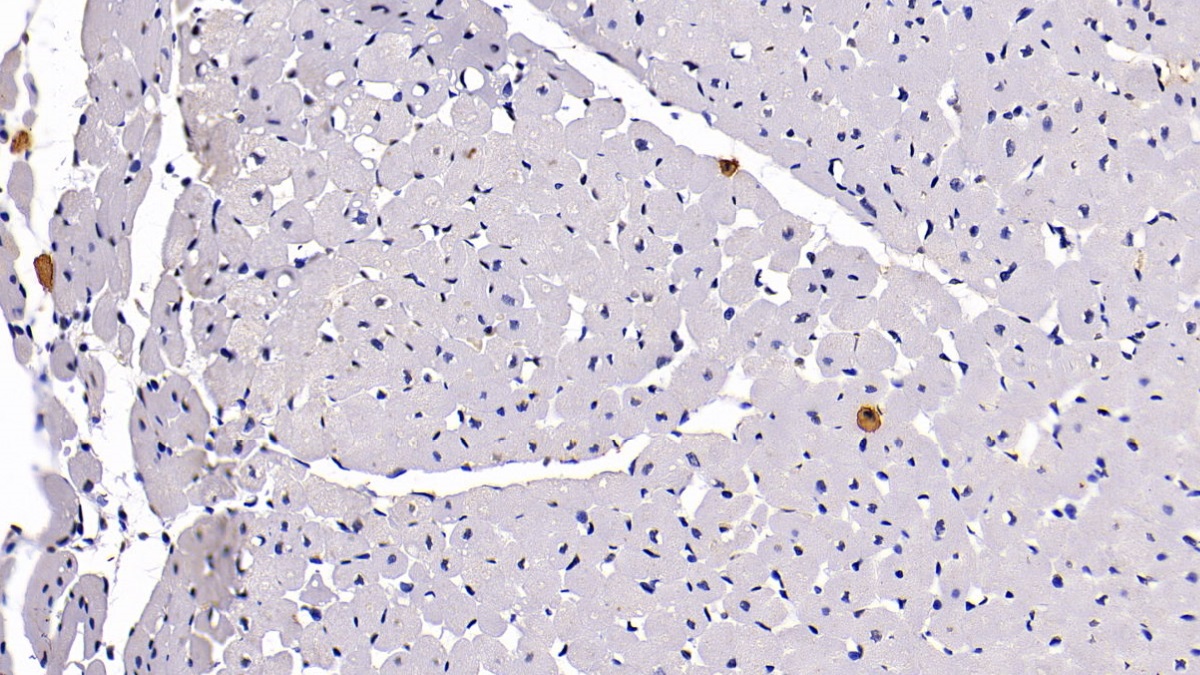 Monoclonal Antibody to Chemokine C-C-Motif Receptor 7 (CCR7)