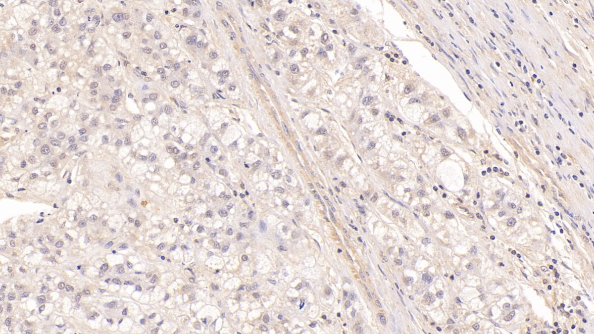 Monoclonal Antibody to Major Basic Protein (MBP)