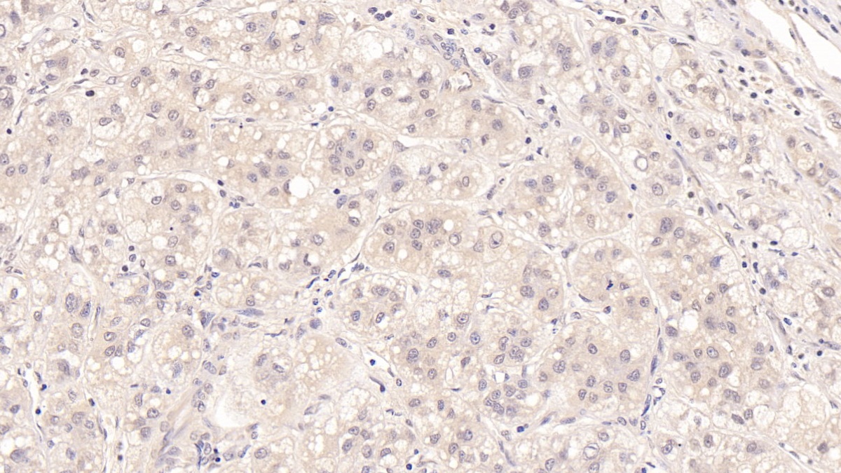 Monoclonal Antibody to Major Basic Protein (MBP)