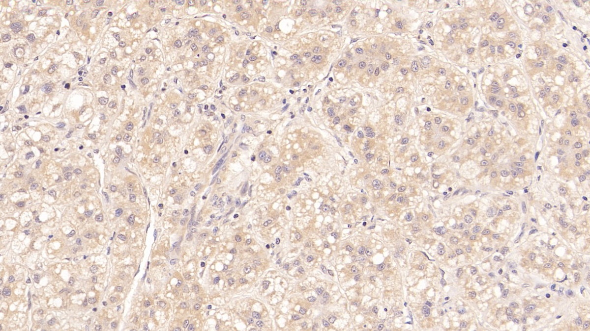 Monoclonal Antibody to Major Basic Protein (MBP)