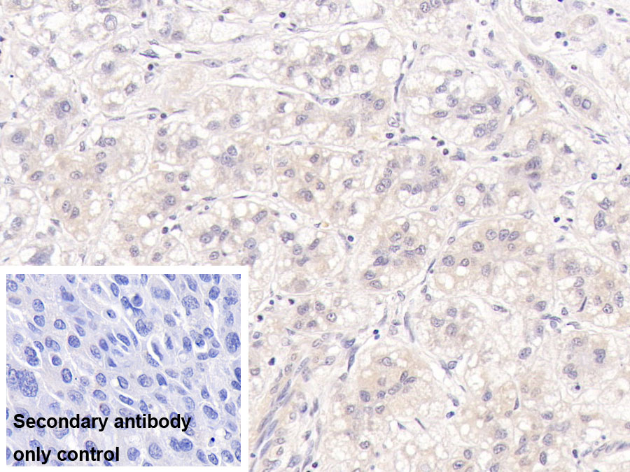 Monoclonal Antibody to Major Basic Protein (MBP)