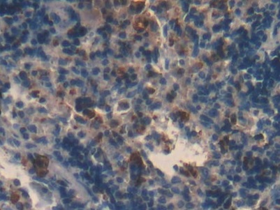 Monoclonal Antibody to Major Basic Protein (MBP)