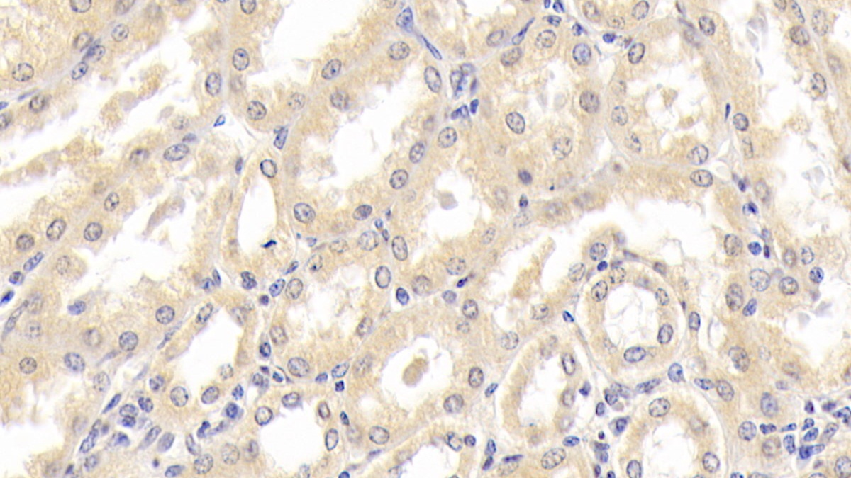 Monoclonal Antibody to CD300 Antigen Like Family Member C (CD300c)