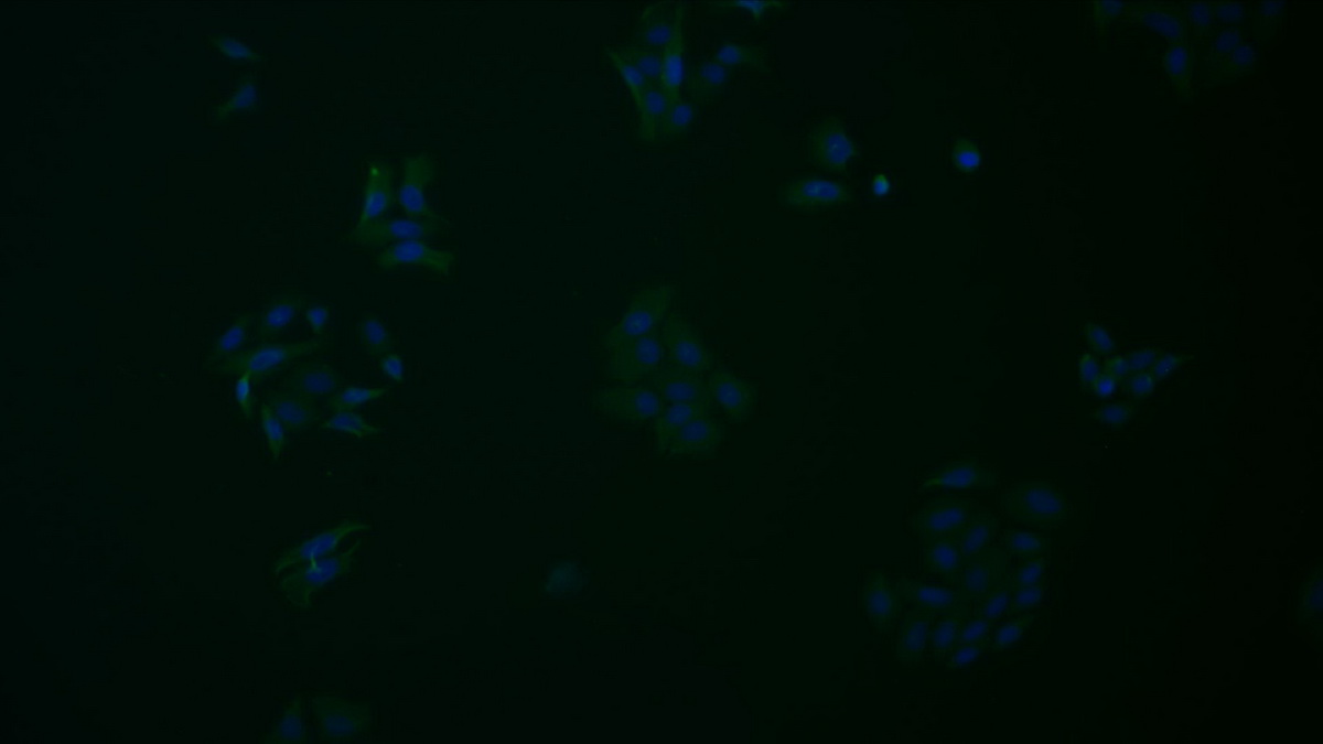 Monoclonal Antibody to Lymphocyte Activation Gene 3 (LAG3)