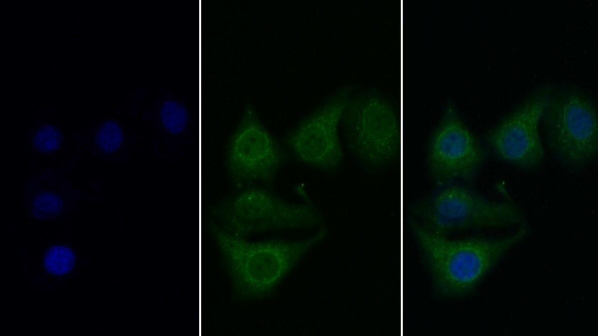 Monoclonal Antibody to Complement Component 1, S Subcomponent (C1s)