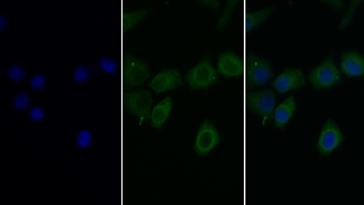 Monoclonal Antibody to Complement Component 1, S Subcomponent (C1s)