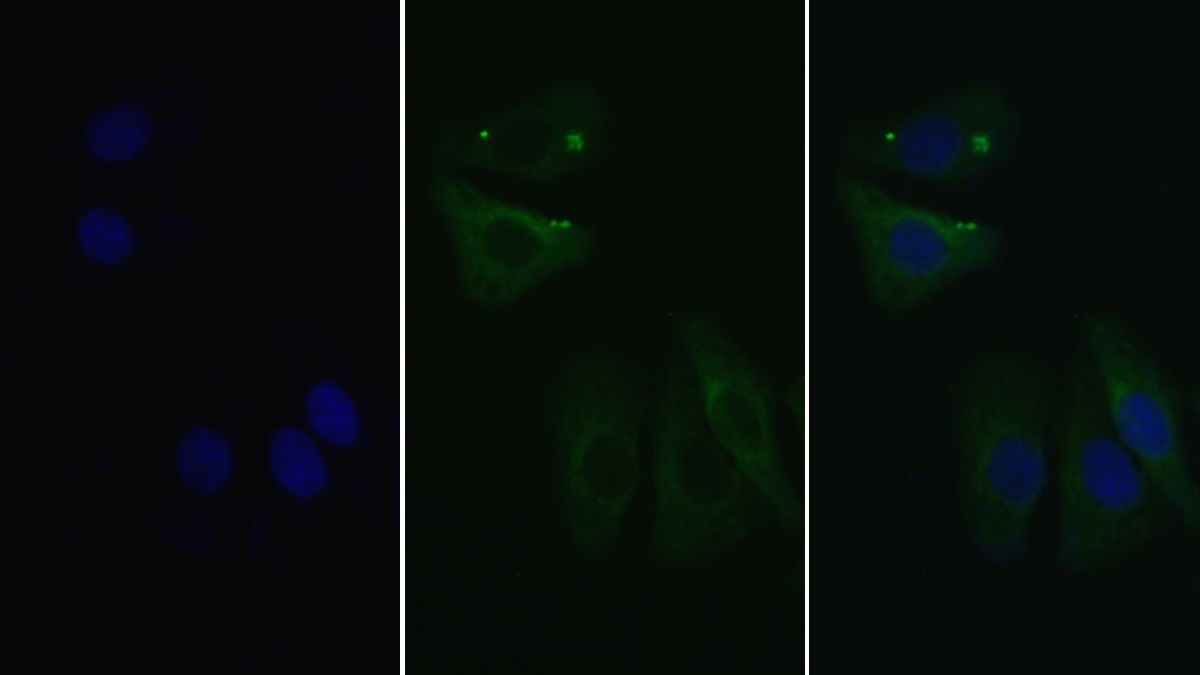 Monoclonal Antibody to Complement Component 1, S Subcomponent (C1s)