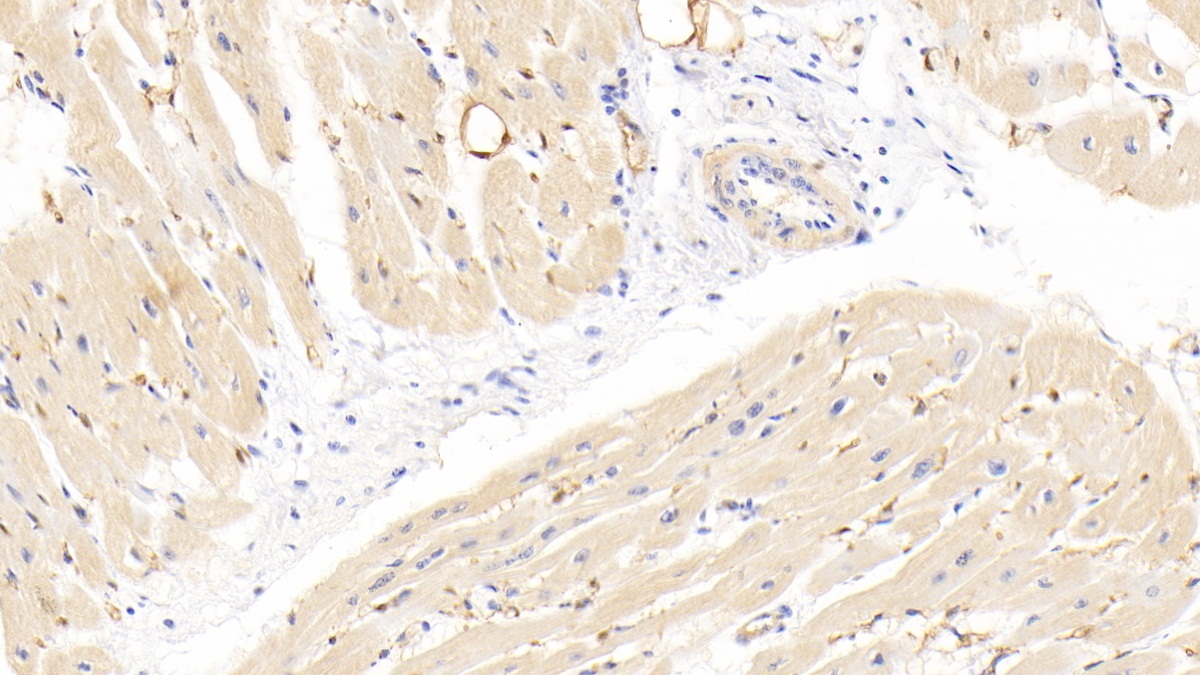 Monoclonal Antibody to Fatty Acid Binding Protein 4 (FABP4)