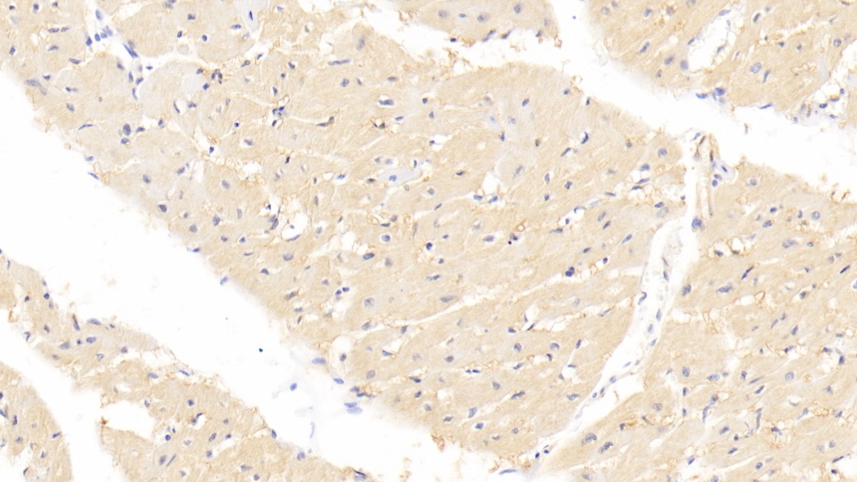 Monoclonal Antibody to Fatty Acid Binding Protein 4 (FABP4)