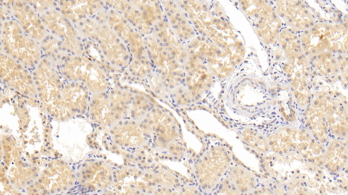 Monoclonal Antibody to Fatty Acid Binding Protein 4 (FABP4)