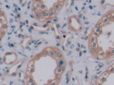 Monoclonal Antibody to Vascular Endothelial Growth Factor 165 (VEGF165)