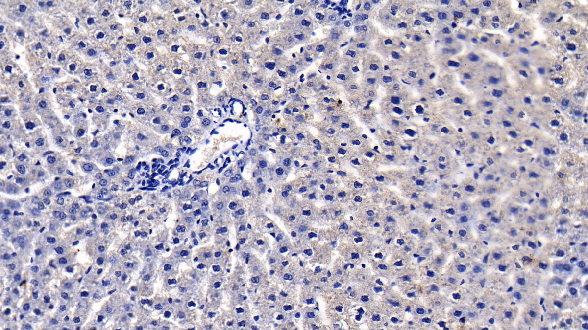 Monoclonal Antibody to Vascular Endothelial Growth Factor 165 (VEGF165)