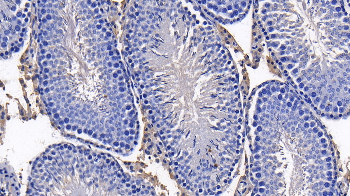 Monoclonal Antibody to Alpha-1-Antitrypsin (a1AT)