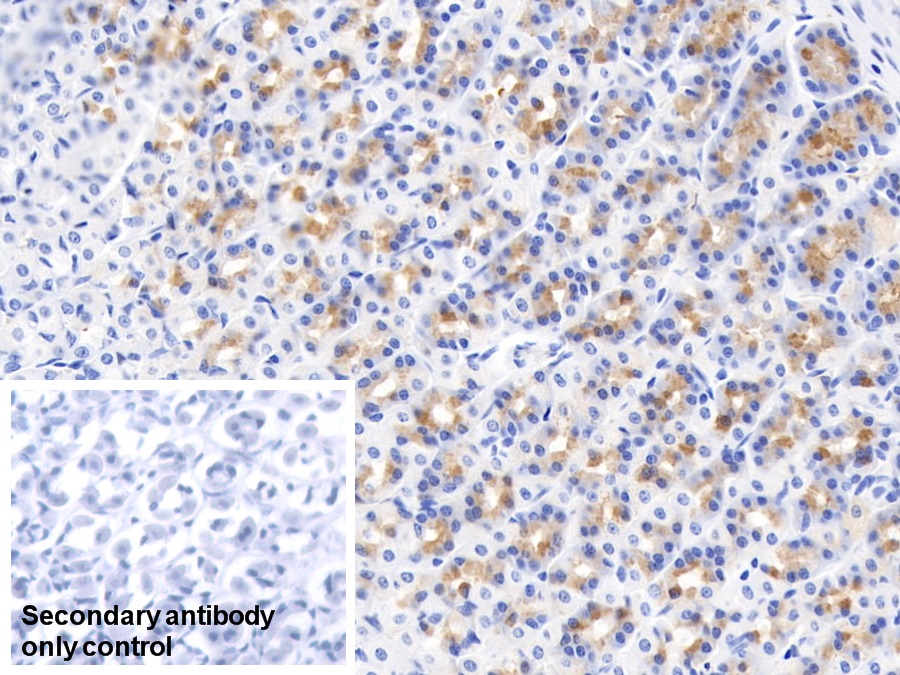 Monoclonal Antibody to Cluster Of Differentiation (CD163)