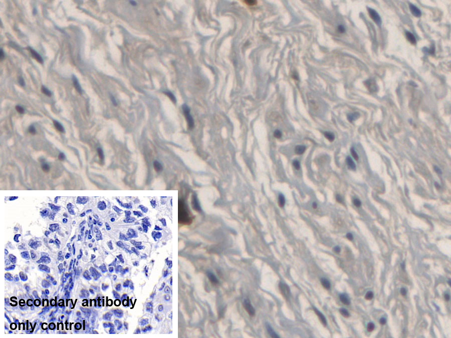 Monoclonal Antibody to Ribonuclease A3 (RNASE3)