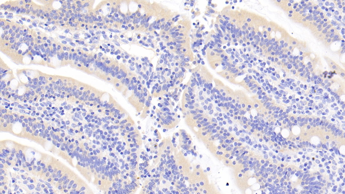 Monoclonal Antibody to Ribonuclease A3 (RNASE3)