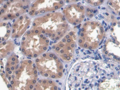 Monoclonal Antibody to Ribonuclease A3 (RNASE3)